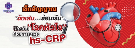 เช็กสัญญาณ 