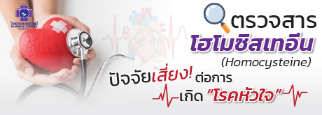 ตรวจสารโฮโมซิสเทอีน (Homocysteine)