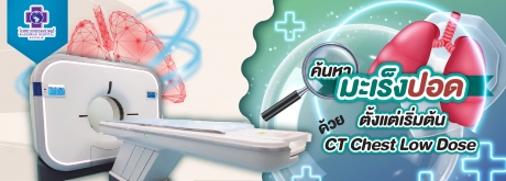 ค้นหามะเร็งปอด ตั้งแต่เริ่มต้นด้วย CT Chest Low Dose