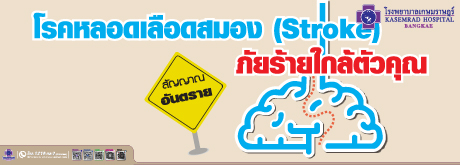 รู้ทันเพื่อป้องกัน โรคหลอดเลือดทางสมอง Stroke