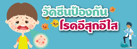 วัคซีนป้องกันโรคอีสุกอีใส