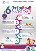 6 ปัจจัยเสี่ยง โรคนิ่วในไต ส่วนมากเกิดขึ้นจากหลายๆ ปัจจัยร่วมกัน