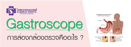 Gastroscope การส่องกล้องตรวจคืออะไร ?