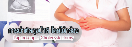 การผ่าตัดถุงน้ำดีโดยใช้กล้อง Laparoscopic Cholecystectomy