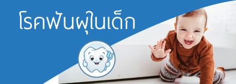 โรคฟันผุในเด็ก...เรื่องเล็กที่ไม่ควรมองข้าม