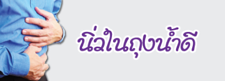 ผ่าตัดถุงน้ำดีผ่านกล้อง