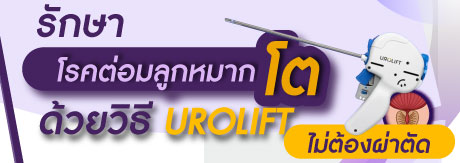 การรักษาต่อมลูกหมากโตด้วยวิธี UROLIFT (ยูโรลิฟต์)