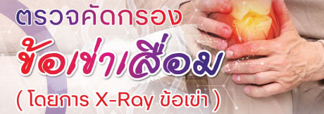 แพ็กเกจตรวจคัดกรองข้อเข่าเสื่อม