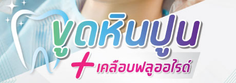 ขูดหินปูน+เคลือบฟลูออไรด์ ใช้สิทธิ์ประกันสังคมร่วมได้