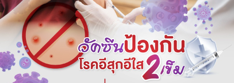 วัคซีนป้องกันโรคอีสุกอีใส  2 เข็ม
