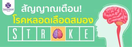 Sroke โรคหลอดเลือดสมอง